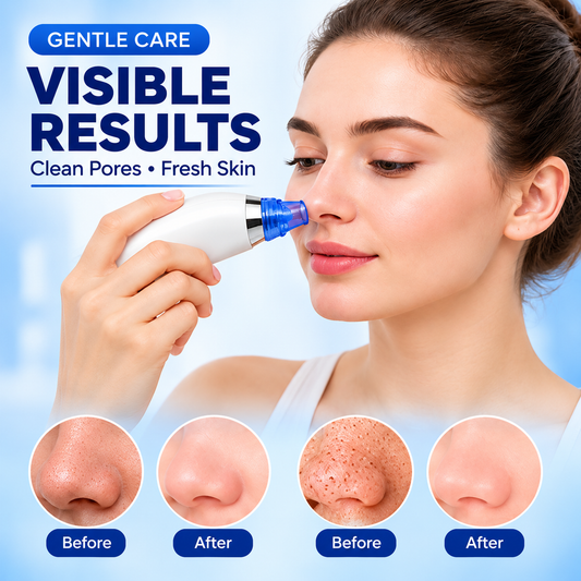 Electric Pore Vacuum Skin Cleaner – 4 in 1 Blackhead Remover, Pore Cleaner & Facial Skin Care Device